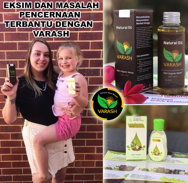 eksim dan masalah pencernaan terbantu varash natural classic oil