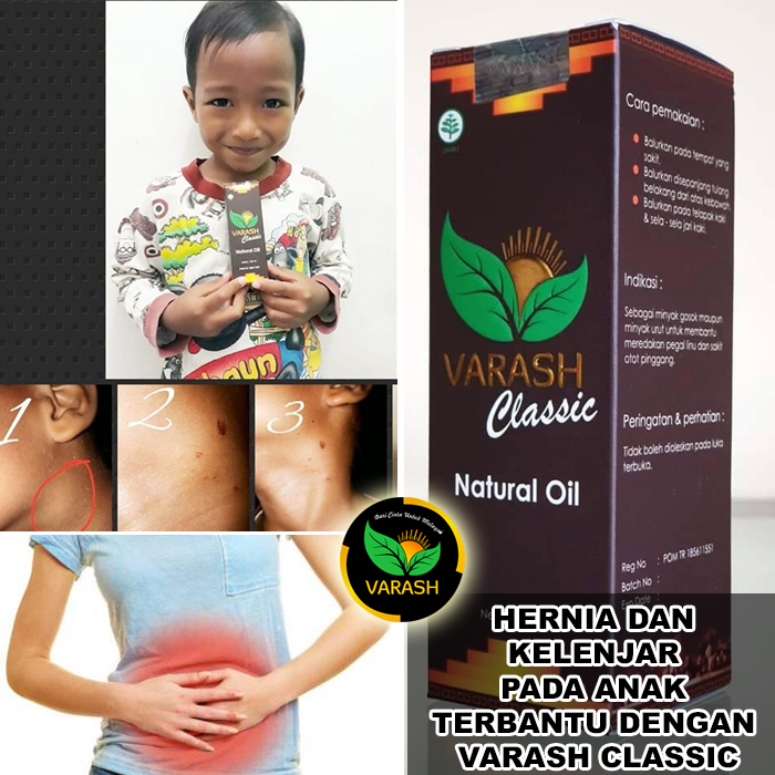 hernia benjolan kelenjar terbantu varash natural classic oil