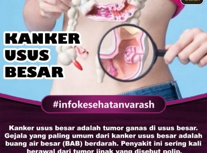 Penyebab Kanker Usus Besar