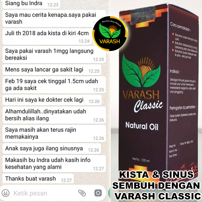 kista sinus sinusitis terbantu varash natural classic oil
