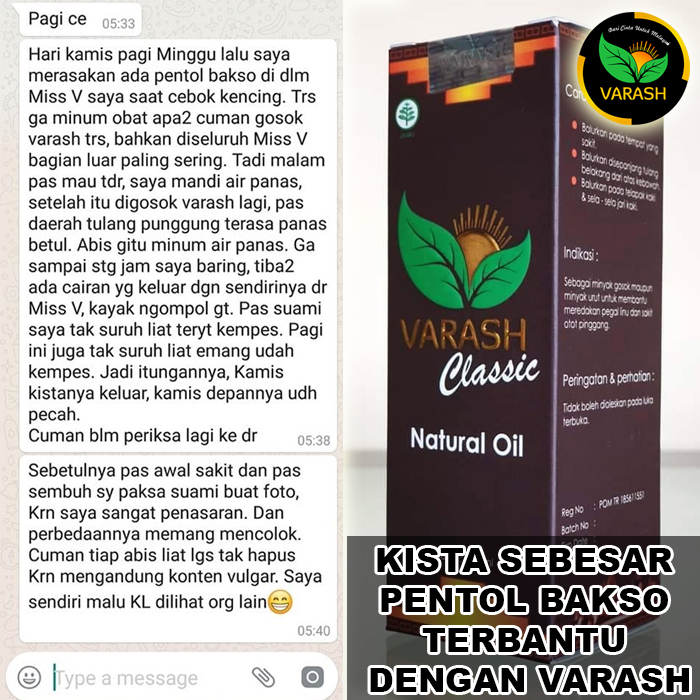 kista sebesar bakso terbantu varash natural classic oil