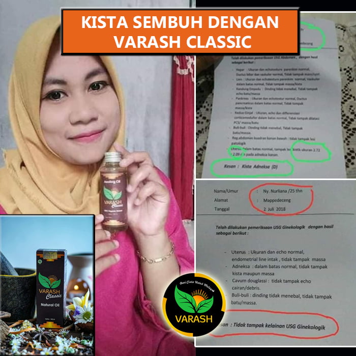 kista terbantu varash natural classic oil