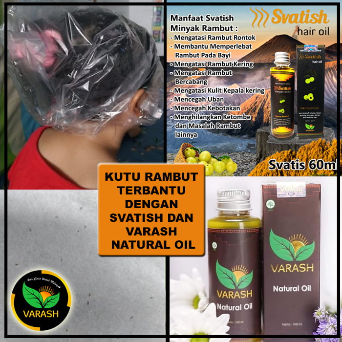 kutu rambut teratasi dengan varash svatish dan varash natural oil