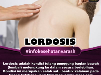 Apa Penyebab Lordosis dan Bagaimana Pengobatannya