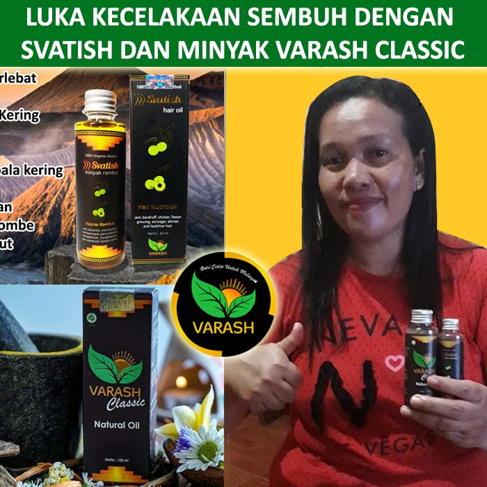 luka kecelakaan terbantu varash natural classic oil