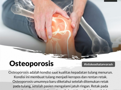 Cara Mengobati Osteoporosis