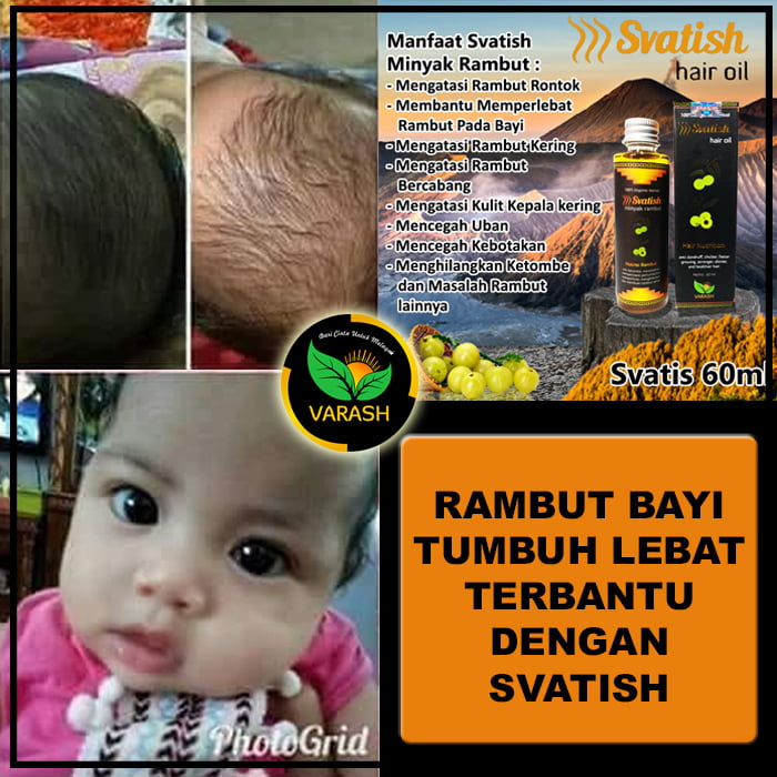 pertumbuhan rambut bayi terbantu varash svatish oil