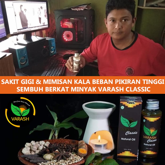sakit gigi, mimisan, stress terbantu varash natural oil