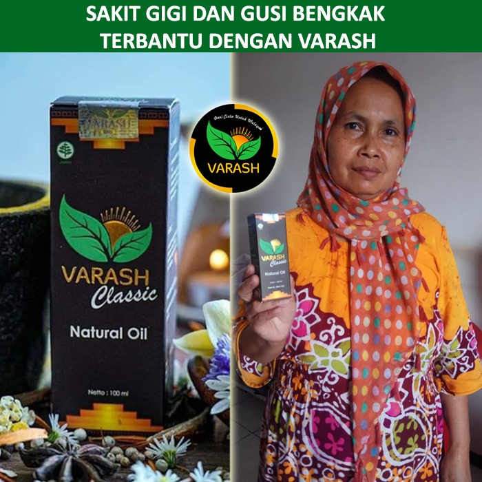 sakit gigi dan gusi bengkak terbantu varash natural classic oil