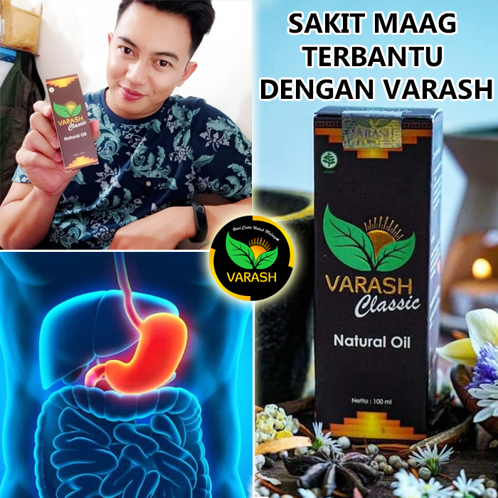 biang keringat terbantu varash natural classic oil