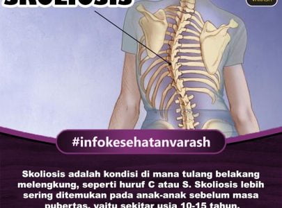 Apa Penyebab Skoliosis dan Bagaimana Pengobatannya