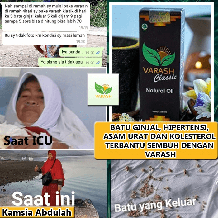 batu ginjal, asam urat, hipertensi, kolesterol terbantu varash natural classic oil