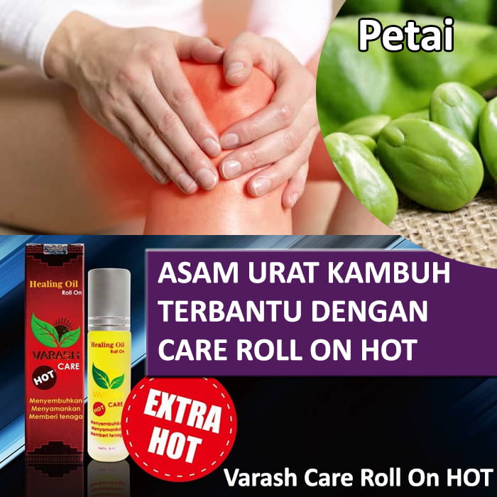asam urat kambuh terbantu varash natural classic oil