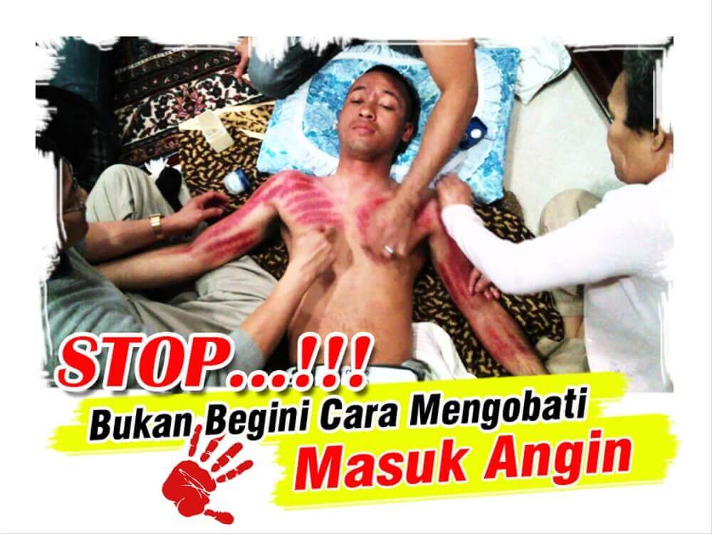 Hasil gambar untuk masuk angin