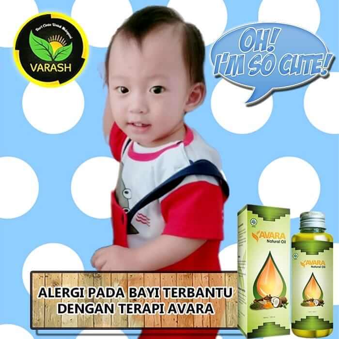 ALERGI PADA BAYI TERBANTU DENGAN TERAPI AVARA