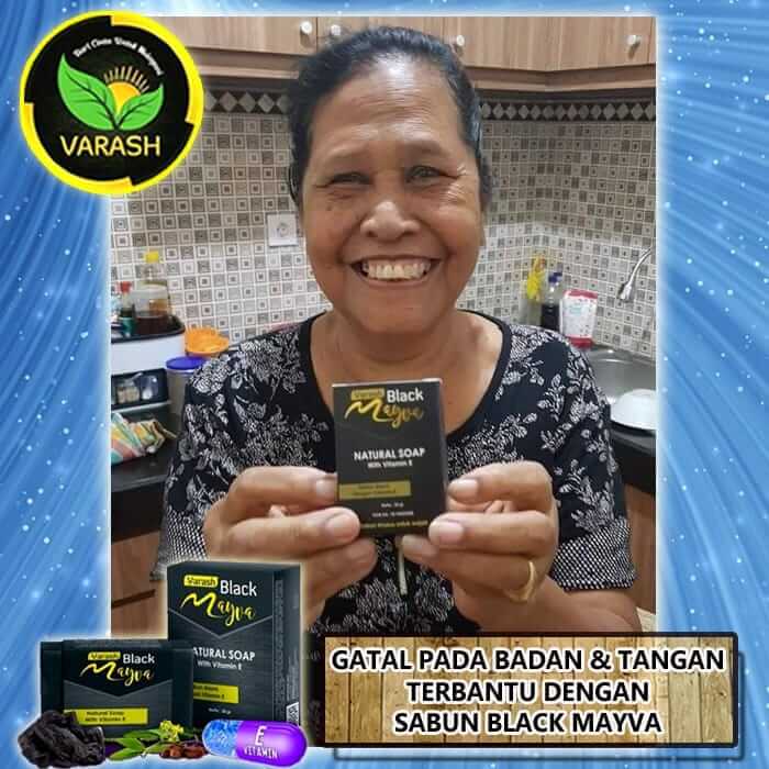 GATAL PADA BADAN DAN TANGAN TERBANTU DENGAN BLACK MAYVA